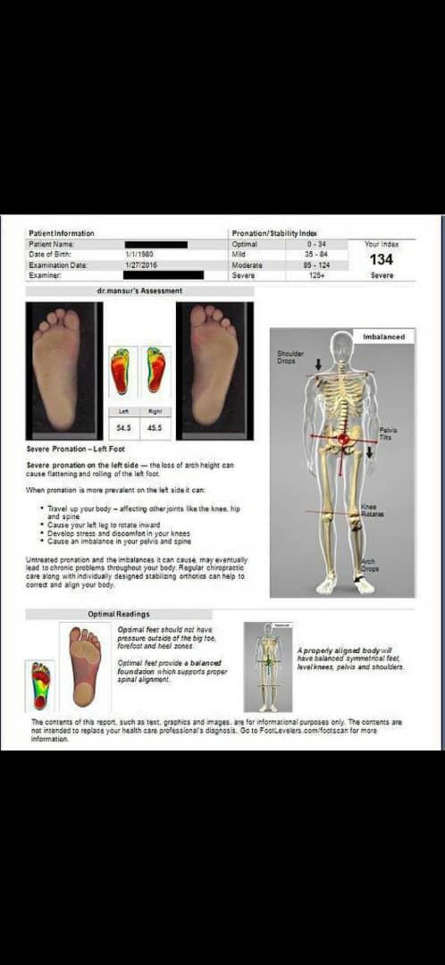 فوت اسکنر سه بعدی 3d body view foot levelersدست دو/مدینیوم