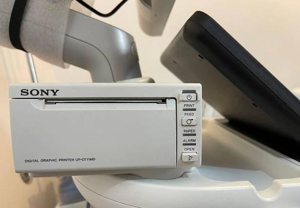 سونوگرافی ایفینیتی 50 (Affiniti 50)دست دو/مدینیوم