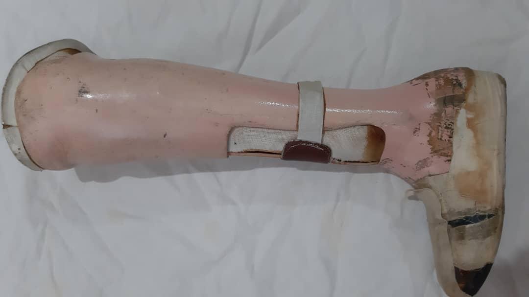 پا مصنوعینو/مدینیوم