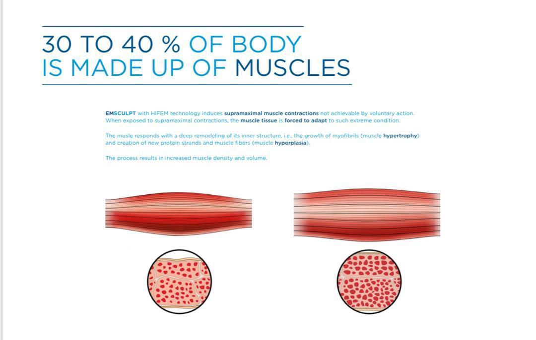 EMSLIME نو/مدینیوم