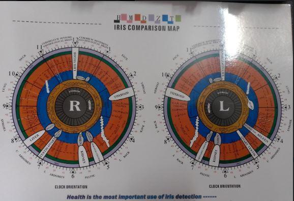دستگاه ایروسکوپ (عنبیه شناسی)نو/مدینیوم