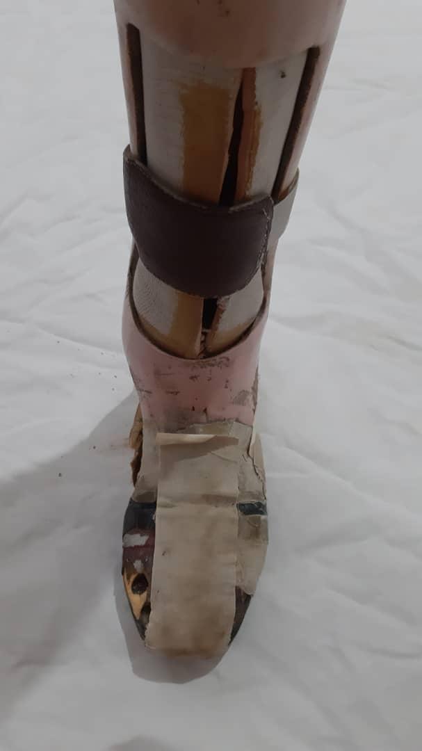 پا مصنوعینو/مدینیوم