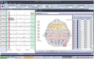 دستگاه نوار مغز EEGنو/مدینیوم
