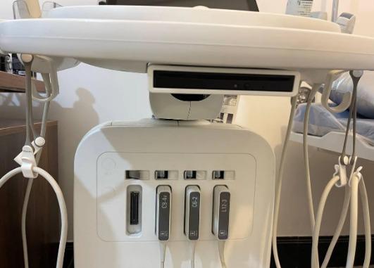 سونوگرافی ایفینیتی 50 (Affiniti 50)دست دو/مدینیوم