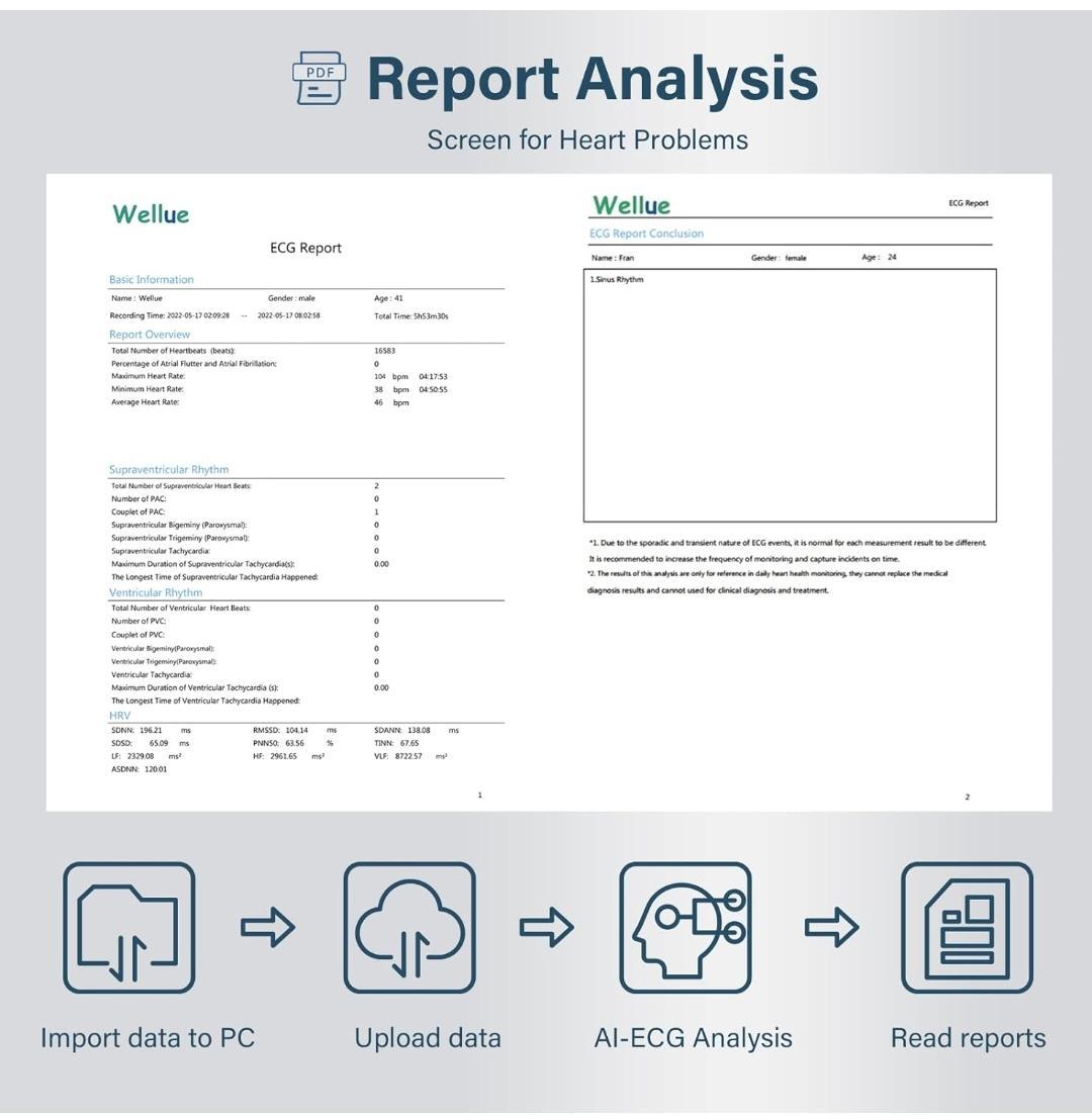 Wallue ecg recorderنو/مدینیوم