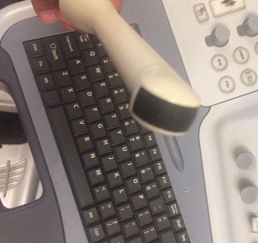 سونوگرافی مدیسون AccuvixXQدست دو/مدینیوم