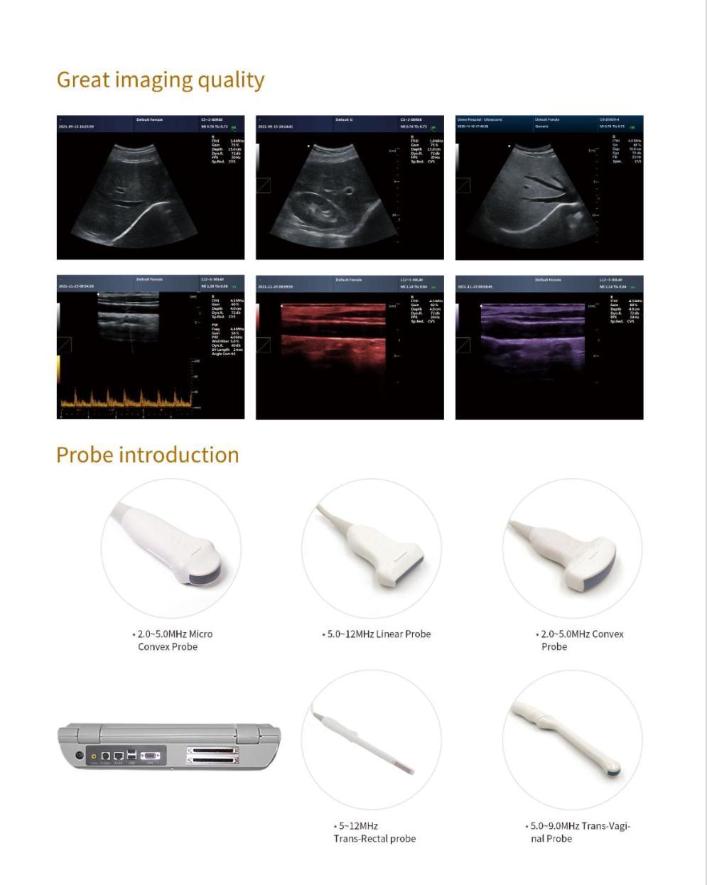 دستگاه سونوگرافی پرتابل CMS600P2plusنو/مدینیوم