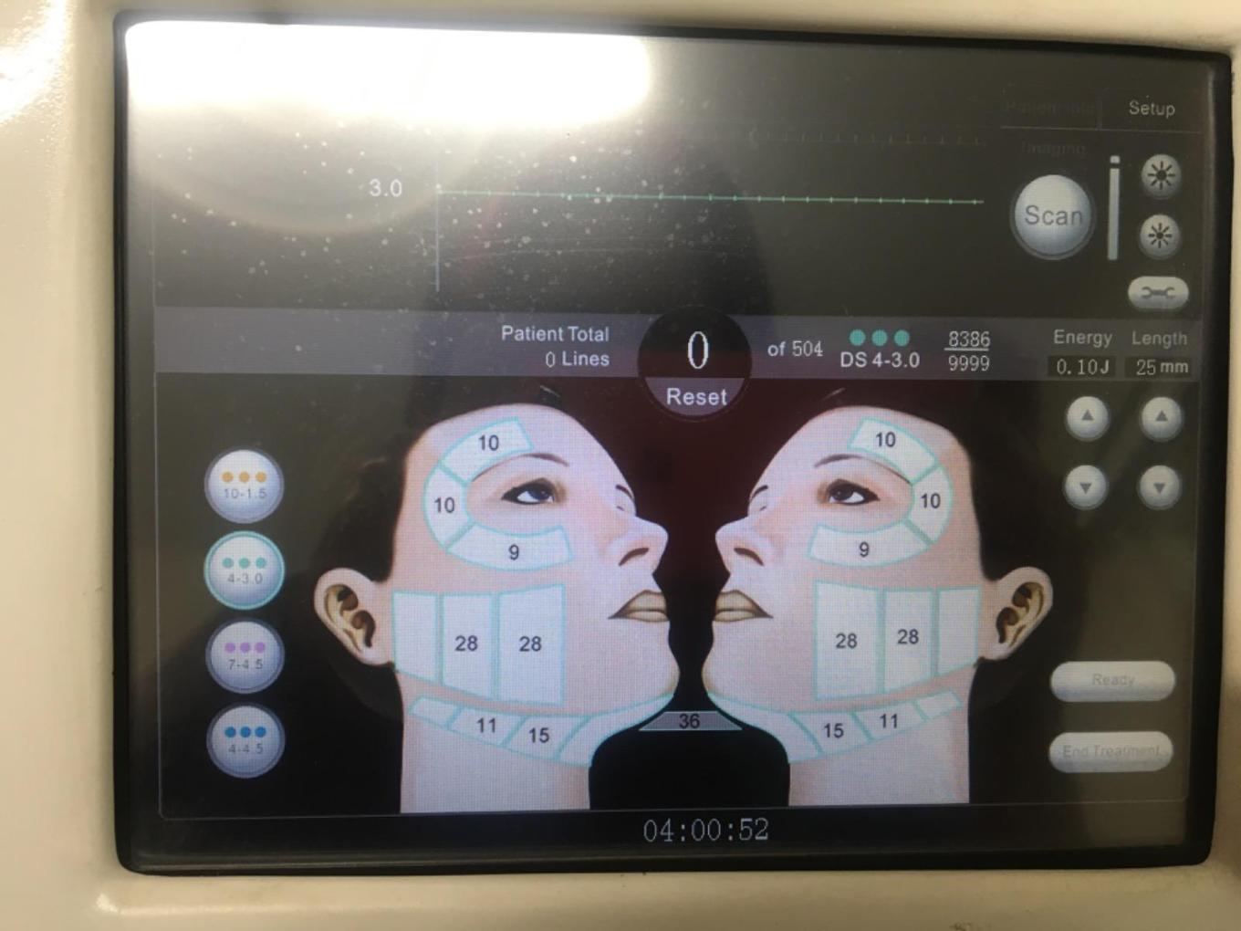 دستگاه هایفو سه بعدی الترادست دو/مدینیوم