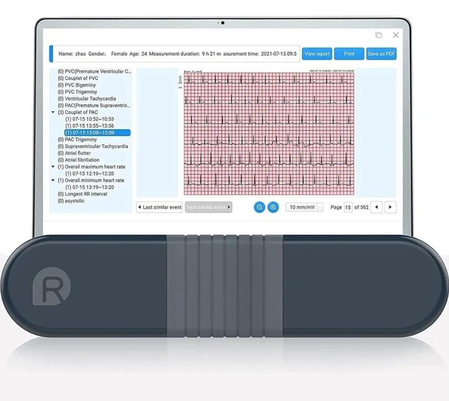 Wallue ecg recorderنو/مدینیوم