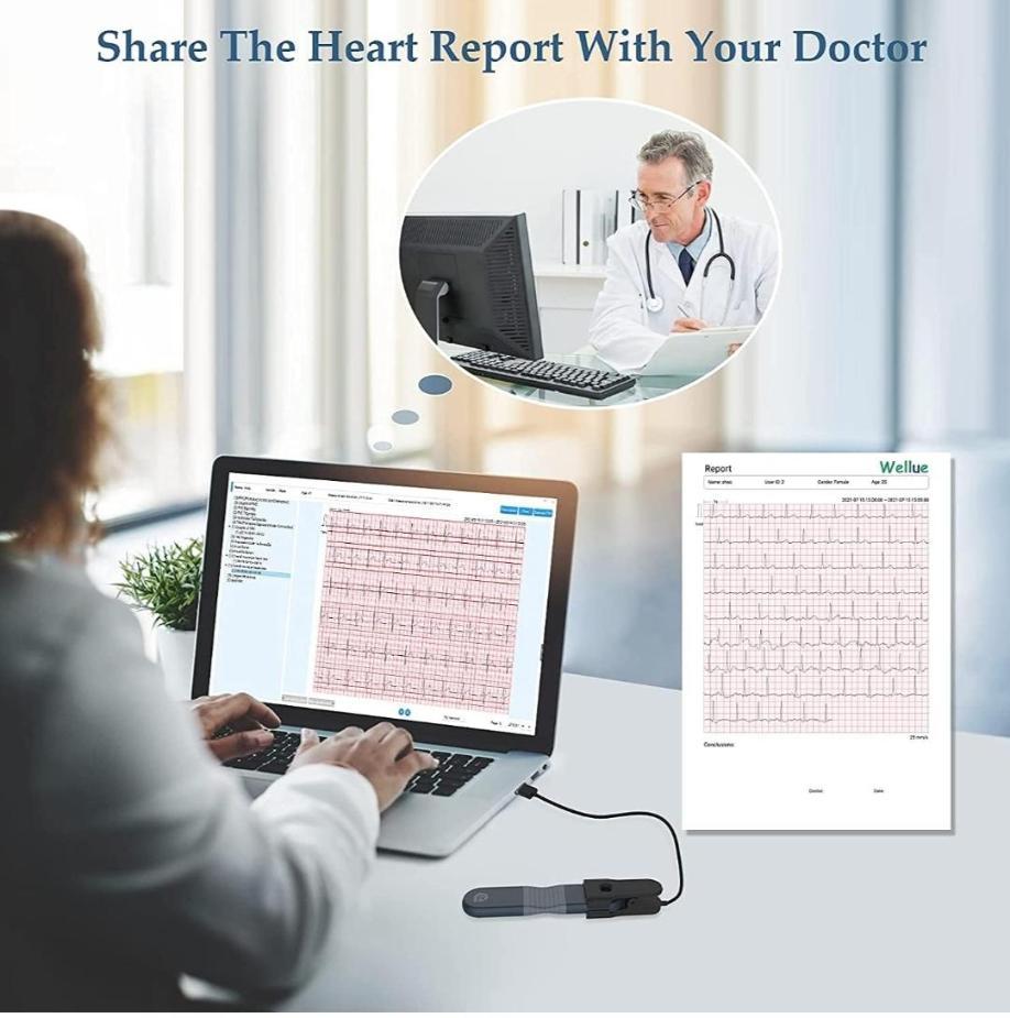 Wallue ecg recorderنو/مدینیوم