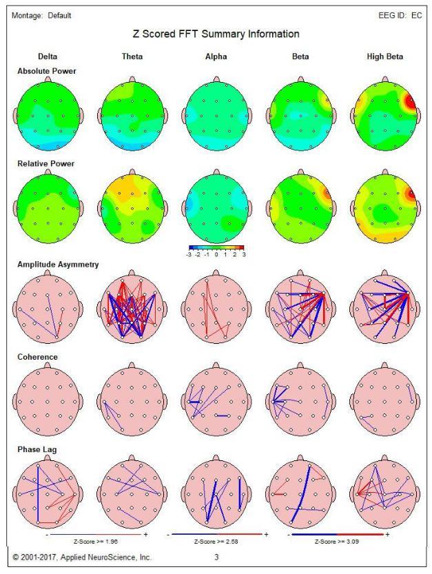 دستگاه نوروفيدبک و QEEG 24 کاناله دست دو/مدینیوم