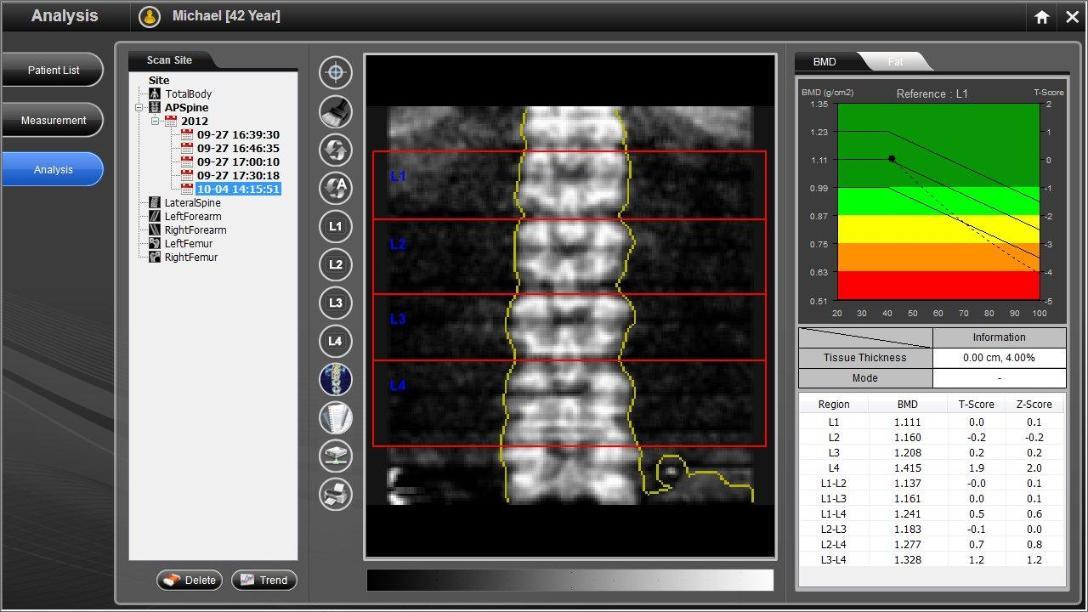 دستگاه تراکم استخوان مدل PRIMUS برند Osteosys کره جنوبینو/مدینیوم