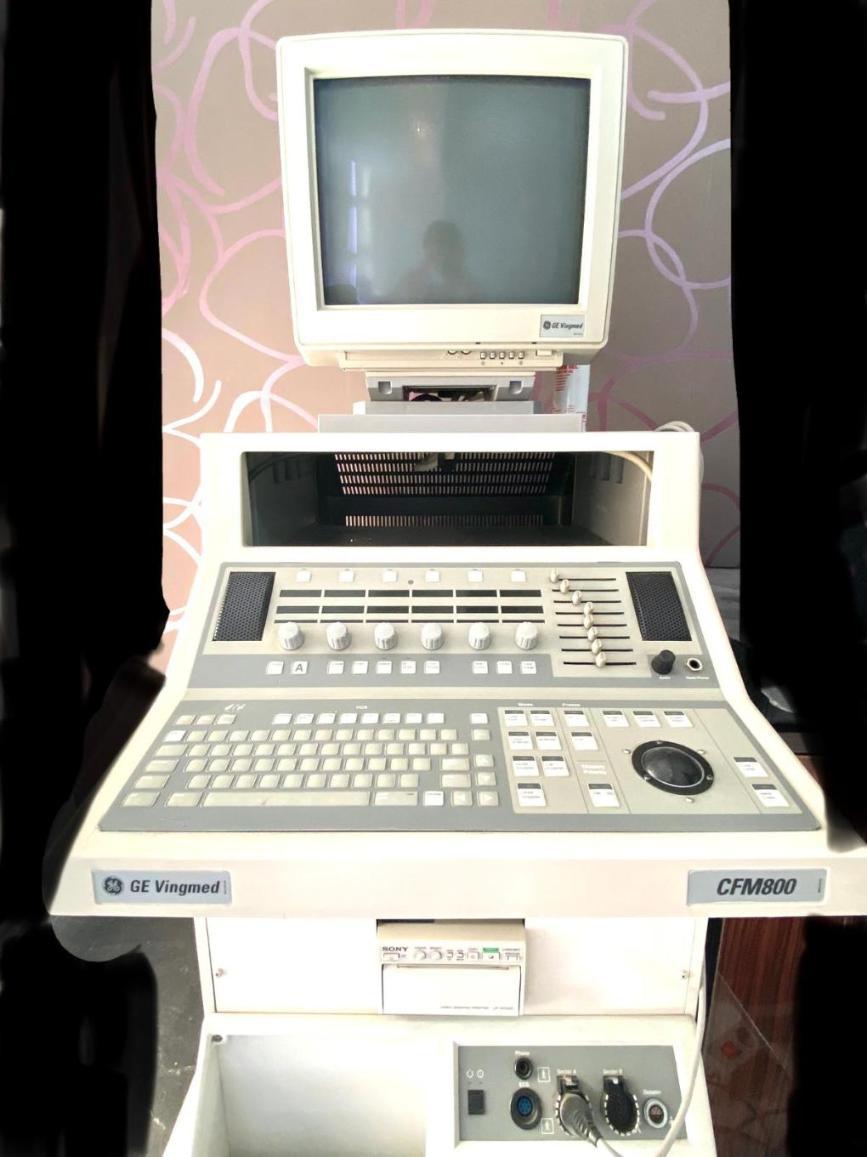 دستگاه اکوکاردیوگرافی جنرال الکتریکدست دو/مدینیوم