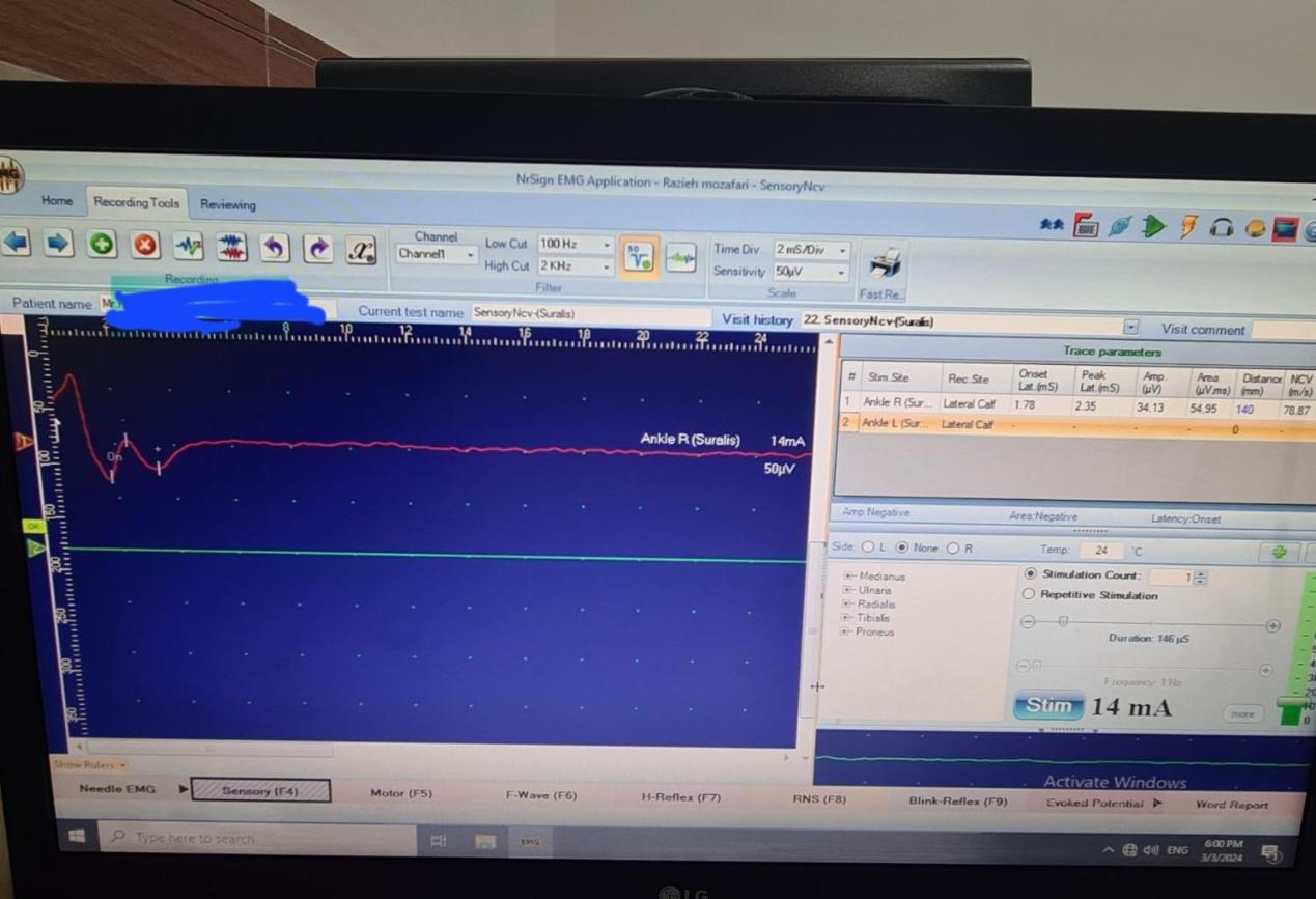 دستگاه نوار عصب وعضله ی چهار کاناله نگار اندیشگاندست دو/مدینیوم