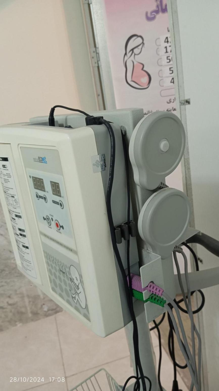 دستگاه فتال مانیتورینگ(Nst) مارک اکونت مدل اسمارت1دست دو/مدینیوم