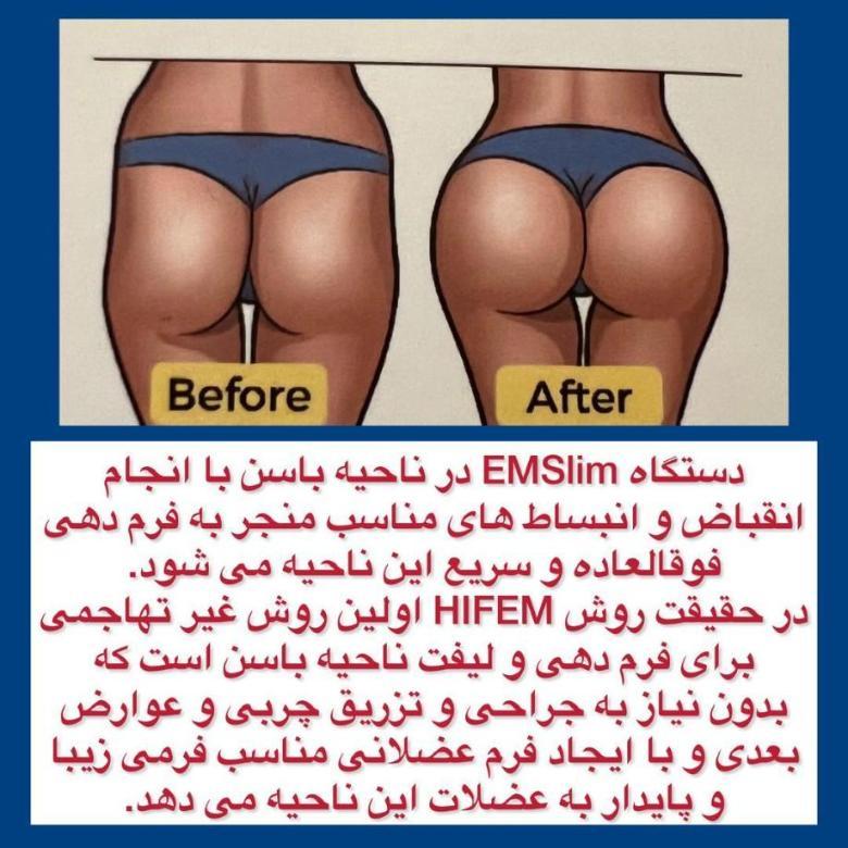 EMSLIME نو/مدینیوم