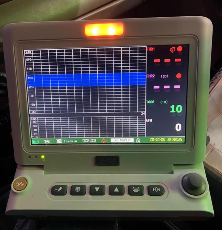 دستگاه Nst فتال مانیتورینگ جنین فنون طب M301Bدست دو/مدینیوم