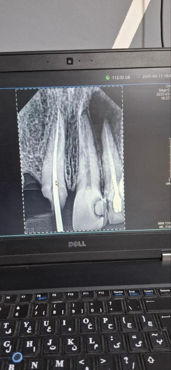 رادیوگرافی و سنسور RVGدست دو/مدینیوم