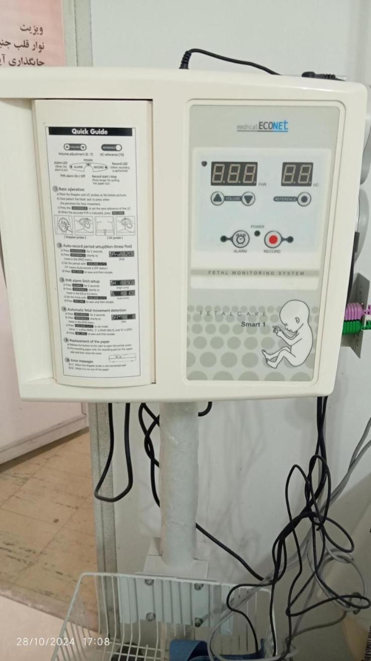 دستگاه فتال مانیتورینگ(Nst) مارک اکونت مدل اسمارت1دست دو/مدینیوم