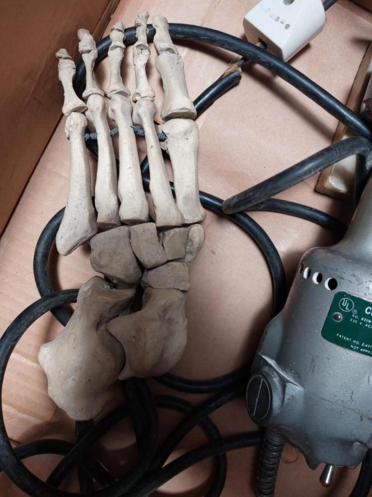 اره ارتوپدی استرایکر و گچ باز کندست دو/مدینیوم