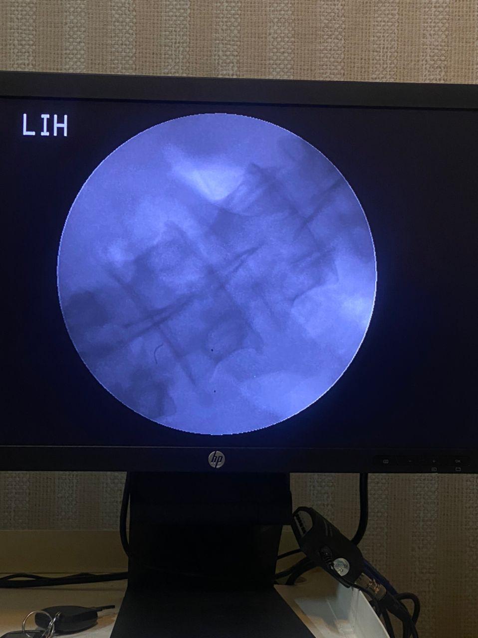 فلوروسکوپی سی آرمدست دو/مدینیوم
