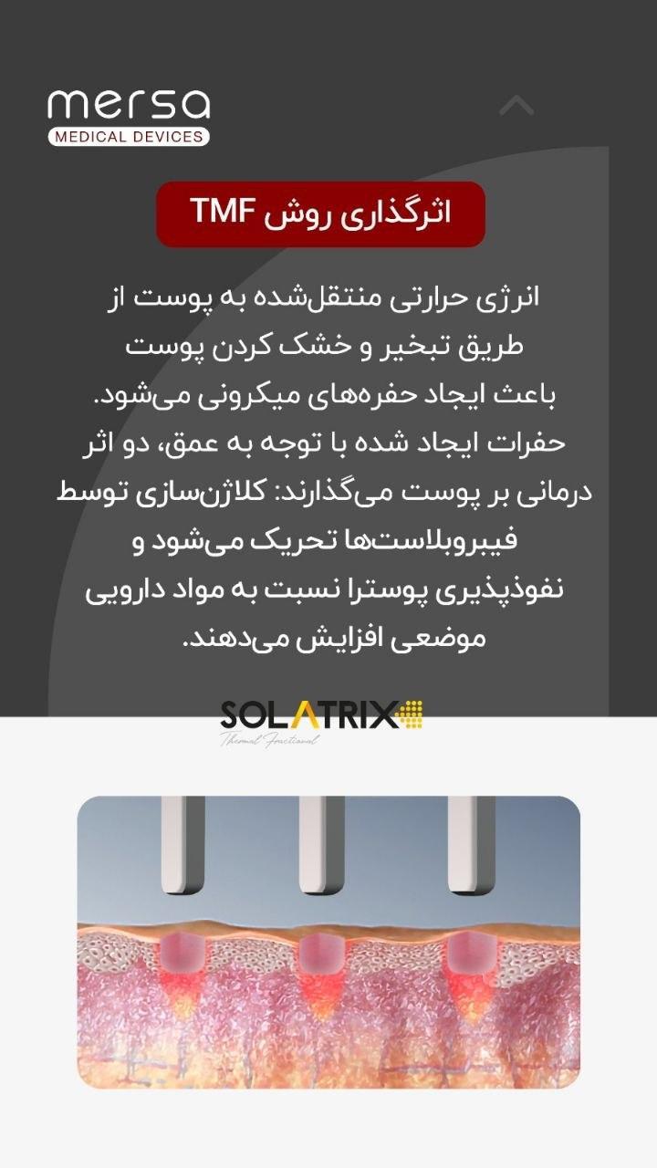 دستگاه ترمومکانیکال سولاتریکس نو/مدینیوم