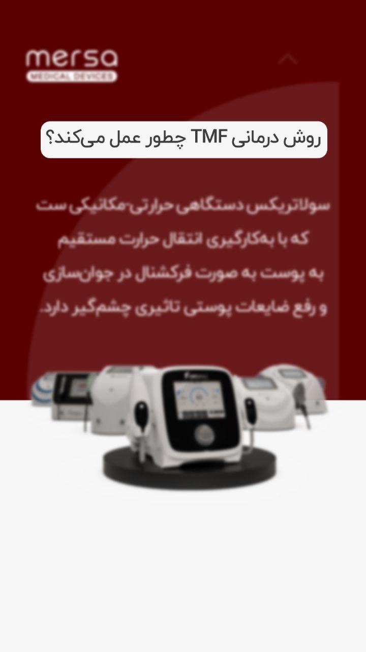 دستگاه ترمومکانیکال سولاتریکس نو/مدینیوم