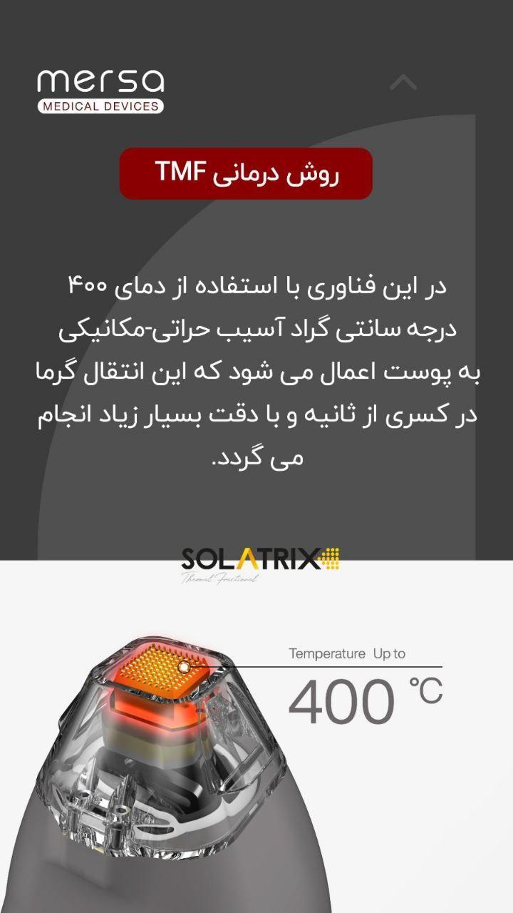 دستگاه ترمومکانیکال سولاتریکس نو/مدینیوم