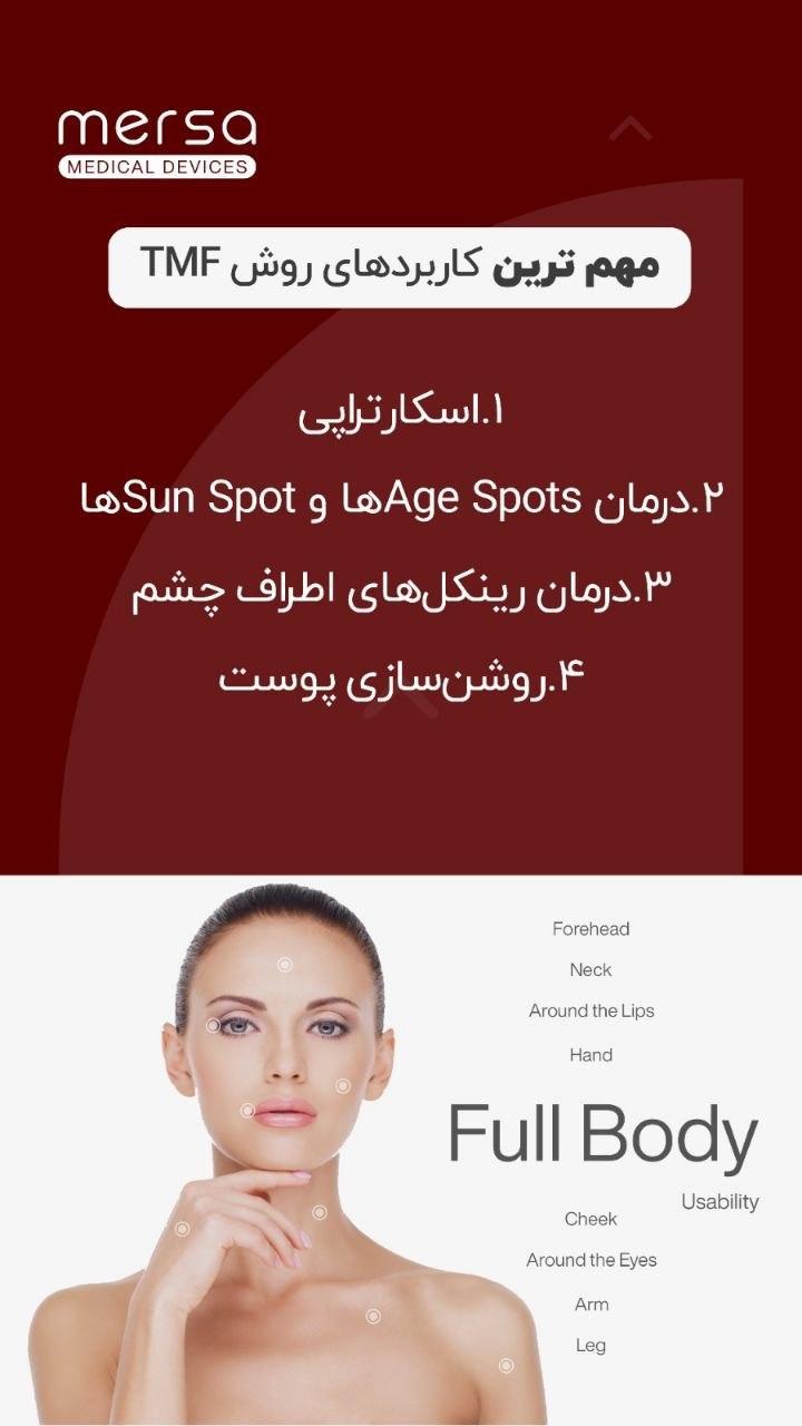 دستگاه ترمومکانیکال سولاتریکس نو/مدینیوم