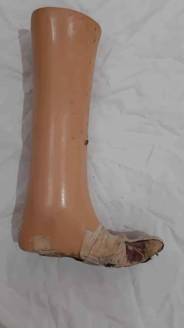 پا مصنوعینو/مدینیوم