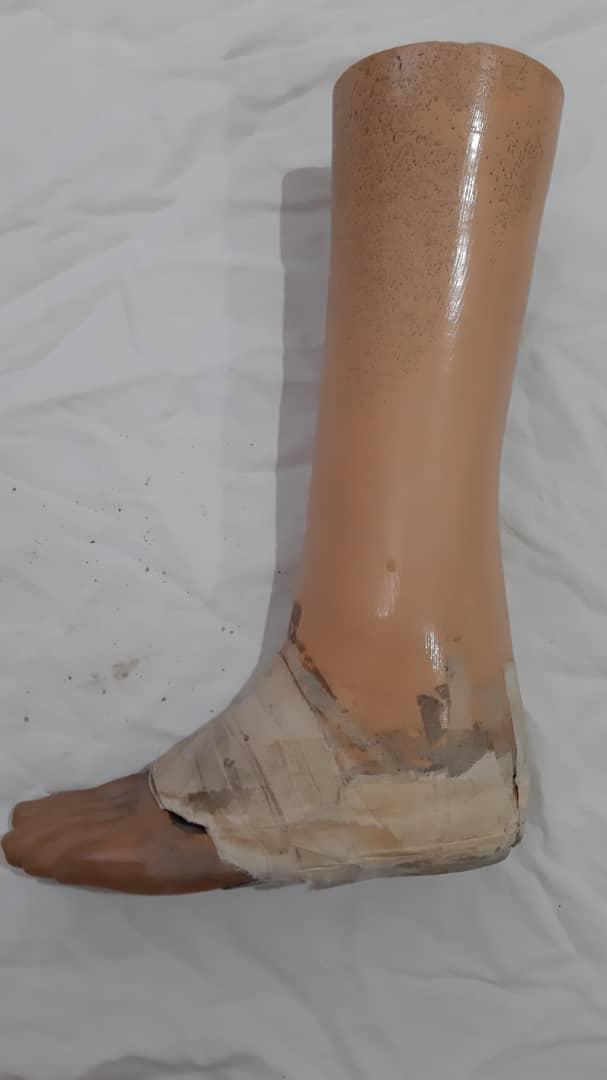 پا مصنوعینو/مدینیوم