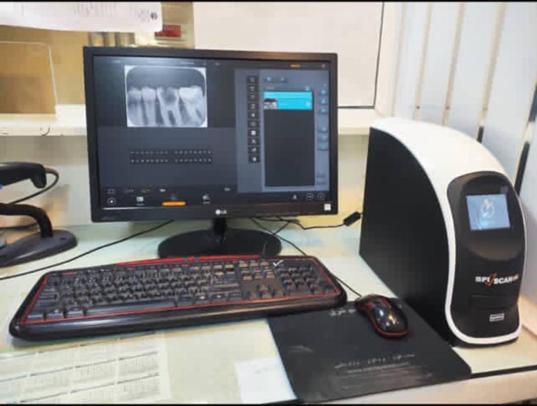 دستگاه فسفر پلیت cr proدست دو/مدینیوم