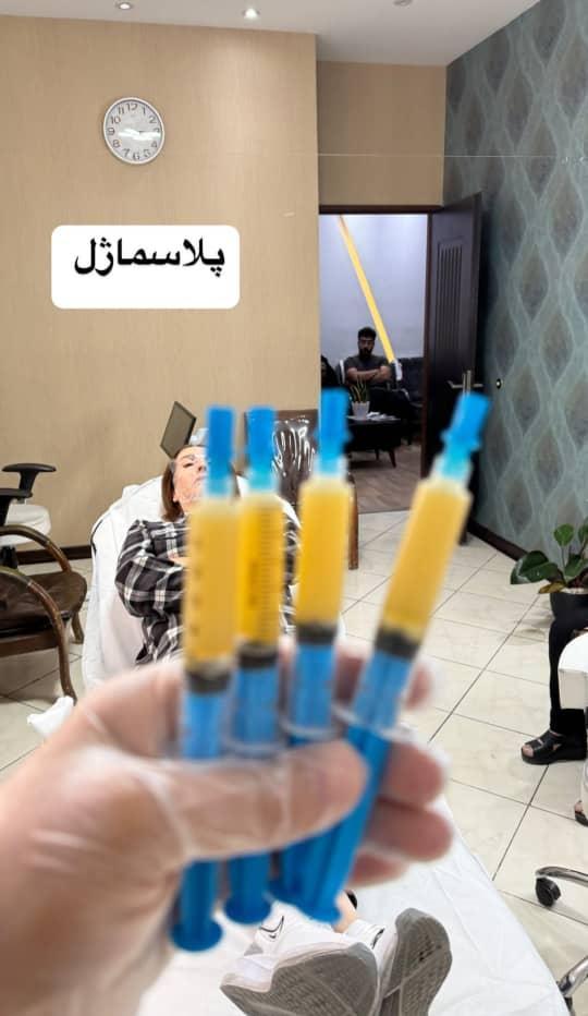 پلاسما ژل یا بایوفیلر رویاننو/مدینیوم